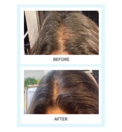 Hair Force Serum & Booster Led Kit - Talika